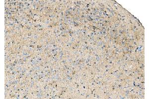 IHC analysis of Ezrin/EZR using anti-Ezrin/EZR antibody (ABIN7603214). (Ezrin 抗体  (N-Term))