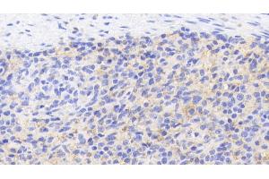 Detection of CD40L in Porcine Spleen Tissue using Polyclonal Antibody to Cluster Of Differentiation 40 Ligand (CD40L) (CD40 Ligand 抗体  (AA 111-261))