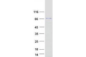 Western Blotting (WB) image for Asteroid Homolog 1 (ASTE1) protein (Myc-DYKDDDDK Tag) (ABIN2715009)
