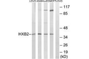 Western blot analysis of extracts from MCF-7/HuvEc/A549/LOVO cells, using HOXB2 Antibody. (HOXB2 抗体  (AA 41-90))