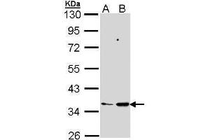WB Image Sample (30 ug of whole cell lysate) A: 293T B: Molt-4 , 10% SDS PAGE antibody diluted at 1:1000 (PTGES2 抗体)