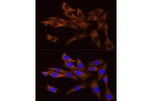 Immunofluorescence analysis of NIH/3T3 cells using Bag1 Rabbit mAb (ABIN7265847) at dilution of 1:50 (40x lens). (BAG1 抗体)