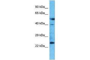 Host:  Rabbit  Target Name:  LAMP5  Sample Type:  Placenta lysates  Antibody Dilution:  1. (LAMP5 抗体  (Middle Region))