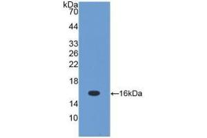 Detection of Recombinant TGFb1, Mouse using Polyclonal Antibody to Transforming Growth Factor Beta 1 (TGFb1) (TGFB1 抗体  (AA 279-390))