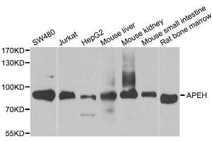 Western blot analysis of extracts of various cell lines, using APEH antibody. (APEH 抗体  (AA 1-260))