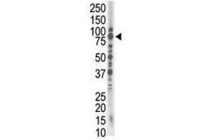 Image no. 1 for anti-SMAD Specific E3 Ubiquitin Protein Ligase 1 (SMURF1) (C-Term) antibody (ABIN357470) (SMURF1 抗体  (C-Term))