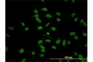 Immunofluorescence of monoclonal antibody to CMAS on HeLa cell. (CMAS 抗体  (AA 164-263))