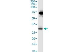 STC2 monoclonal antibody (M08), clone 2B11. (Stanniocalcin 2 抗体  (AA 1-302))