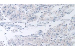 Detection of b4GALNT2 in Human Stomach Tissue using Polyclonal Antibody to Beta-1,4-N-Acetyl Galactosaminyl Transferase 2 (b4GALNT2) (B4GALNT2 抗体  (AA 324-566))