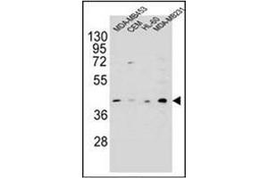 Western blot analysis of HHLA2 Antibody (N-term) in MDA-MB453, CEM, HL-60, MDA-MB231 cell line lysates (35ug/lane). (HHLA2 抗体  (N-Term))
