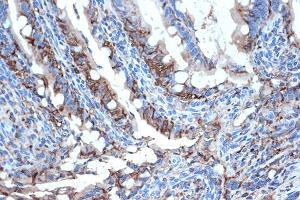 Immunohistochemistry of paraffin-embedded rat intestine using FABPI Rabbit mAb (ABIN7267151) at dilution of 1:100 (40x lens). (FABP2 抗体)
