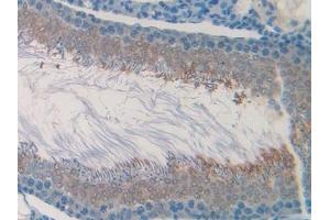 Detection of CHRM1 in Rat Testis Tissue using Polyclonal Antibody to Cholinergic Receptor, Muscarinic 1 (CHRM1) (CHRM1 抗体  (AA 210-363))