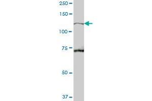 TBC1D2 MaxPab polyclonal antibody. (TBC1D2 抗体  (AA 1-502))
