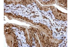 Immunohistochemistry (IHC) image for anti-Proteasome Subunit alpha 6 (PSMA6) (Center) antibody (ABIN2856913)