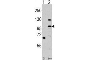 Western Blotting (WB) image for anti-Mitogen-Activated Protein Kinase Kinase Kinase MLK4 (KIAA1804) antibody (ABIN3003622) (MLK4 抗体)