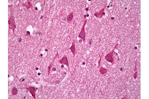 Anti-GUCY1B3 / Guanylyl Cyclase Beta 1 antibody IHC of human brain, cortex neurons. (GUCY1B3 抗体)