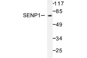 Image no. 1 for anti-SUMO1/sentrin Specific Peptidase 1 (SENP1) antibody (ABIN271955) (SENP1 抗体)