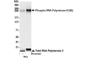 anti-RNA Polymerase II (C-Term) antibody