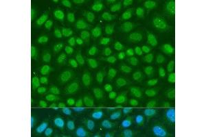 Immunofluorescence analysis of U2OS cells using TAF11 Polyclonal Antibody at dilution of 1:100. (TAF11 抗体)