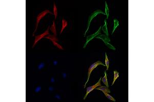 ABIN6259350 and ABIN6275567 staining 3 by IF/ICC.