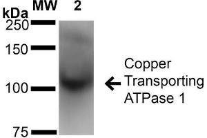 Western Blot analysis of Rat Brain Membrane showing detection of ~180 kDa Copper Transporting ATPase 1 protein using Mouse Anti-Copper Transporting ATPase 1 Monoclonal Antibody, Clone S60-4 . (ATP7A 抗体  (AA 42-61) (APC))