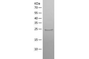 ZNF10 Protein (AA 20-242) (His tag)