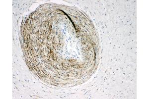Anti-Calponin antibody, IHC(P) IHC(P): Human Placenta Tissue (CNN1 抗体  (C-Term))