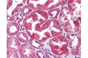 Immunohistochemistry (IHC) image for anti-Signal Transducer and Activator of Transcription 3 (Acute-Phase Response Factor) (STAT3) (N-Term) antibody (ABIN6745716)