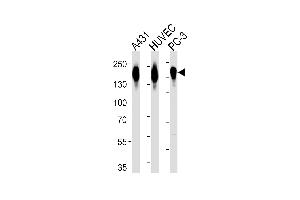 Western blot analysis of lysates from A431, HUVEC, PC-3 cell line (from left to right), using EGFR Antibody (p) (ABIN651628 and ABIN2840334). (EGFR 抗体  (C-Term))