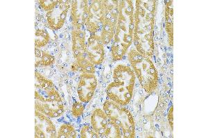 Immunohistochemistry of paraffin-embedded Mouse kidney using Parkin antibody  at dilution of 1:100 (40x lens). (Parkin 抗体  (AA 1-300))