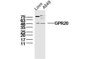 Lane 1: LOVO lysates Lane 2: A549 lysates probed with GPR20 Polyclonal Antibody, Unconjugated  at 1:300 dilution and 4˚C overnight incubation. (GPR20 抗体  (AA 51-150))