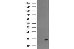 Image no. 1 for anti-TP53RK Binding Protein (TPRKB) antibody (ABIN1501485) (TPRKB 抗体)