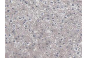 Immunohistochemistry (IHC) image for anti-Chemokine (C-X-C Motif) Ligand 14 (CXCL14) (AA 35-111) antibody (ABIN7433843)