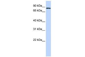 TFR2 antibody used at 1 ug/ml to detect target protein. (Transferrin Receptor 2 抗体  (Middle Region))