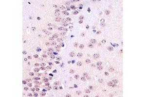 Immunohistochemistry (IHC) image for anti-TATA Box Binding Protein (TBP) antibody (ABIN3029100)