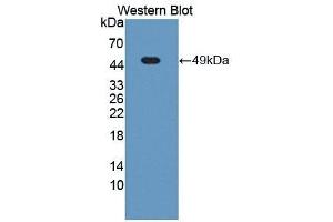 Detection of Recombinant NUMA1, Human using Polyclonal Antibody to Nuclear Mitotic Apparatus Protein 1 (NUMA1) (NUMA1 抗体  (AA 1700-2115))
