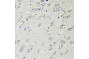 Immunohistochemistry of paraffin-embedded rat brain using OGDH antibody (ABIN6131413, ABIN6145002, ABIN6145004 and ABIN6216119) at dilution of 1:100 (40x lens). (alpha KGDHC 抗体  (AA 148-427))