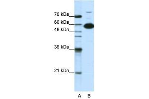 NONO antibody used at 1. (NONO 抗体  (C-Term))