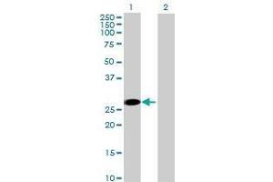 Lane 1: ZMYND19 transfected lysate ( 26. (ZMYND19 293T Cell Transient Overexpression Lysate(Denatured))