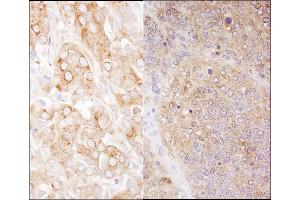 Immunohistochemistry (IHC) image for anti-Eukaryotic Translation Elongation Factor 2 (EEF2) (AA 808-858) antibody (ABIN7454538)