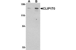 Western blot analysis of CLIP170 in rat brain tissue lysate with AP30238PU-N CLIP170 antibody at (A) 0. (CABS1 抗体  (C-Term))