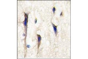 Image no. 1 for anti-Cdc42 Guanine Nucleotide Exchange Factor (GEF) 9 (Arhgef9) (Middle Region) antibody (ABIN357844) (Arhgef9 抗体  (Middle Region))