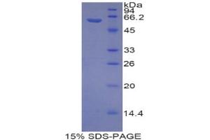 SDS-PAGE analysis of Rat Reprimo Protein. (Reprimo Protein (RPRM))