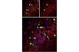 Expression of mGluR5 in rat hippocampus - Immunohistochemical staining of perfusion-fixed frozen rat hippocampus sections using Anti-mGluR5 (extracellular) Antibody (ABIN7043250, ABIN7044332 and ABIN7044333), (1:50). (Metabotropic Glutamate Receptor 5 抗体  (Extracellular))