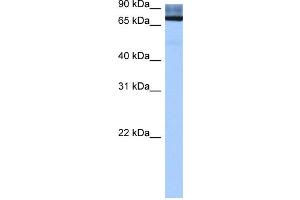 WB Suggested Anti-ADAD2 Antibody Titration:  0. (ADAD2 抗体  (Middle Region))