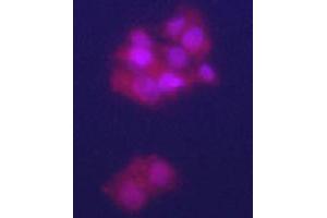 Immunofluorecence staining of GPC3 polyclonal antibody  on HepG2 cells . (Glypican 3 抗体  (N-Term))