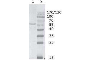 Western Blot testing of HIV-1 Gag p17/24 using HIV-1 p24 antibody, clone N13 (05-006). (HIV-1 p24 抗体  (C-Term))