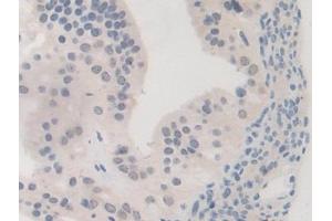 Immunohistochemistry (IHC) image for anti-Bromodomain Containing 8 (BRD8) (AA 797-951) antibody (ABIN7443590)