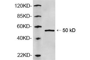 Western blot analysis of recombinant human AP2M1 protein using 1 µg/mL Rabbit Anti-AP2M1 Polyclonal Antibody (ABIN398781) The signal was developed with IRDyeTM 800 Conjugated Goat Anti-Rabbit IgG. (AP2M1 抗体  (N-Term))