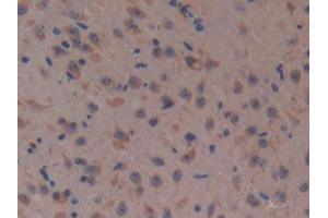 DAB staining on IHC-P; Samples: Mouse Brain Tissue (Complement Factor H 抗体  (AA 915-1156))